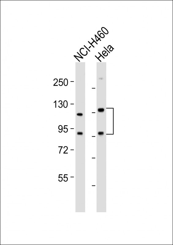 SLCO1B3