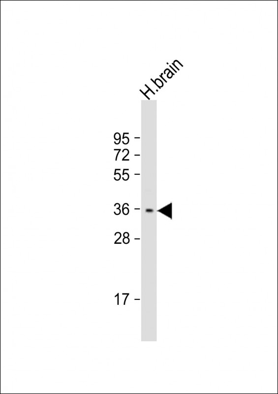 C1orf201 (N-term)