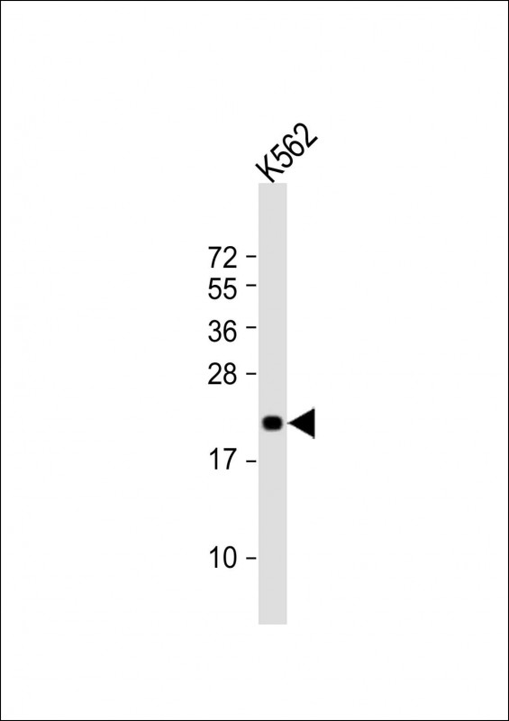 FEV (N-Term)