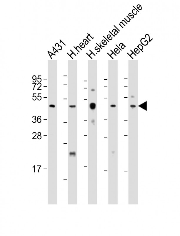 TFDP2