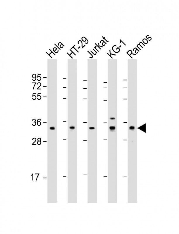 SPPL2B (N-Term)
