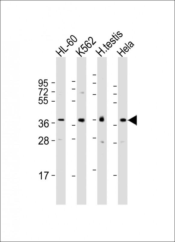 PRSS21 (N-Term)