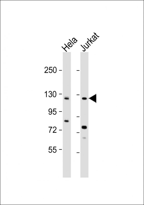 SRGAP3