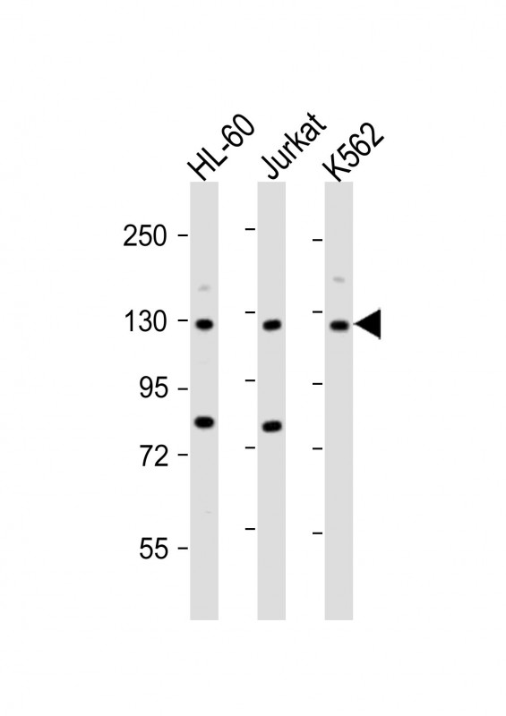 ATP2A3 (N-Term)