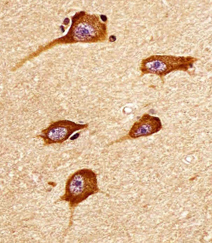 Rabbit Polyclonal Antibody to ATP2A3 (N-Term)