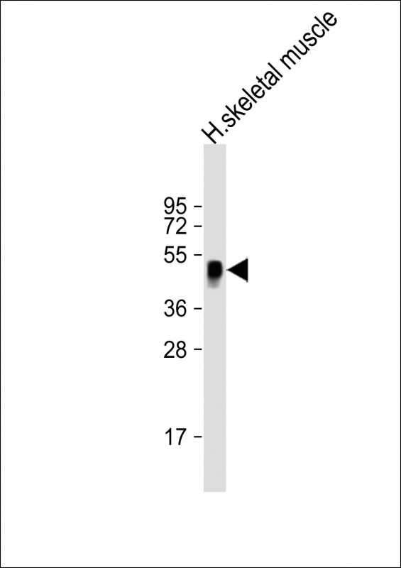 WNT11