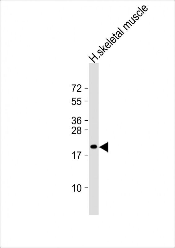 NACA2 (N-Term)