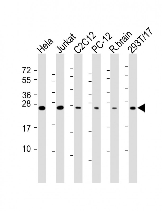 RAB11A
