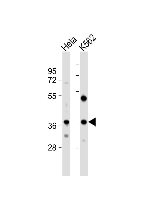 CTDSPL (N-term)