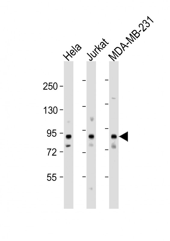 MYSM1  (N-term)
