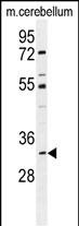 Rabbit Polyclonal Antibody to ALKBH6