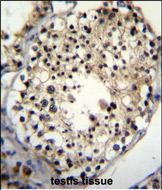 Rabbit Polyclonal Antibody to ALKBH6