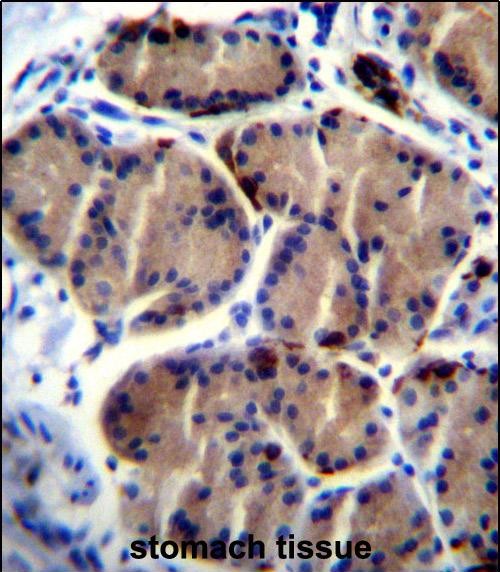 Rabbit Polyclonal Antibody to LIPC