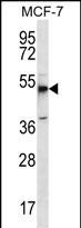 Rabbit Polyclonal Antibody to MBOAT4
