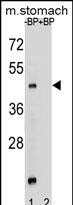 Rabbit Polyclonal Antibody to MBOAT4