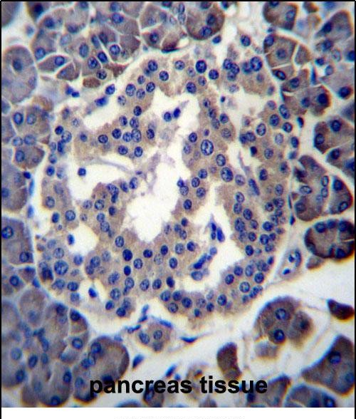 Rabbit Polyclonal Antibody to MBOAT4