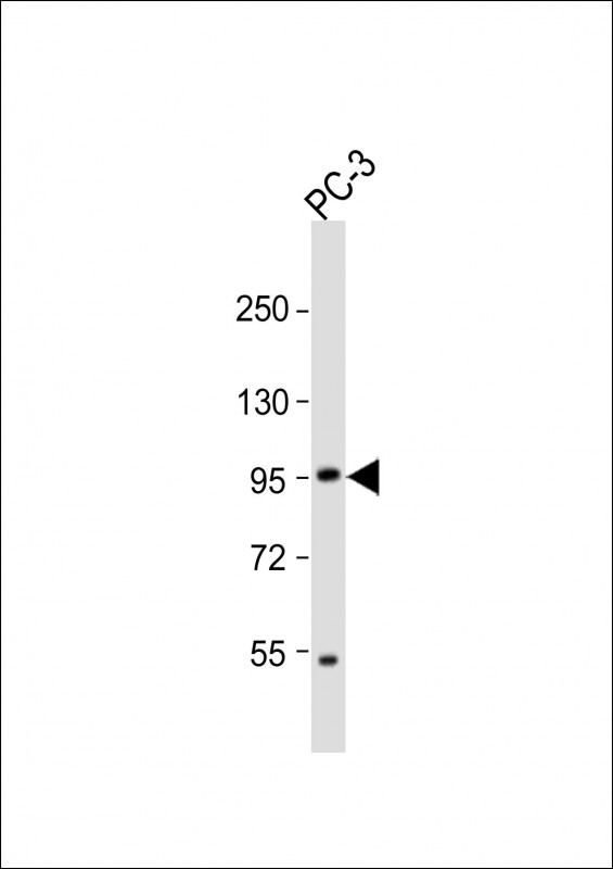 Mouse Pkn3 (N-term)