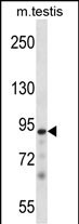 Rabbit Polyclonal Antibody to Mouse Pkn3 (N-term)