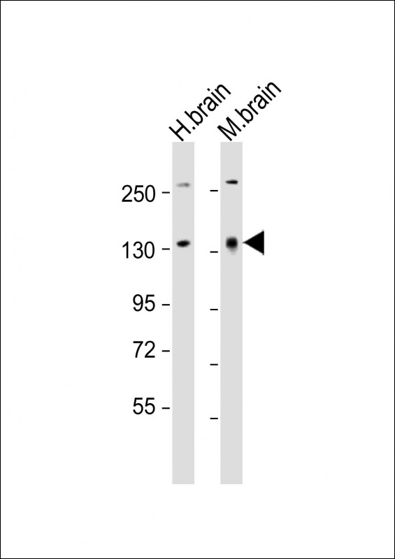 ATXN2 (N-Term)