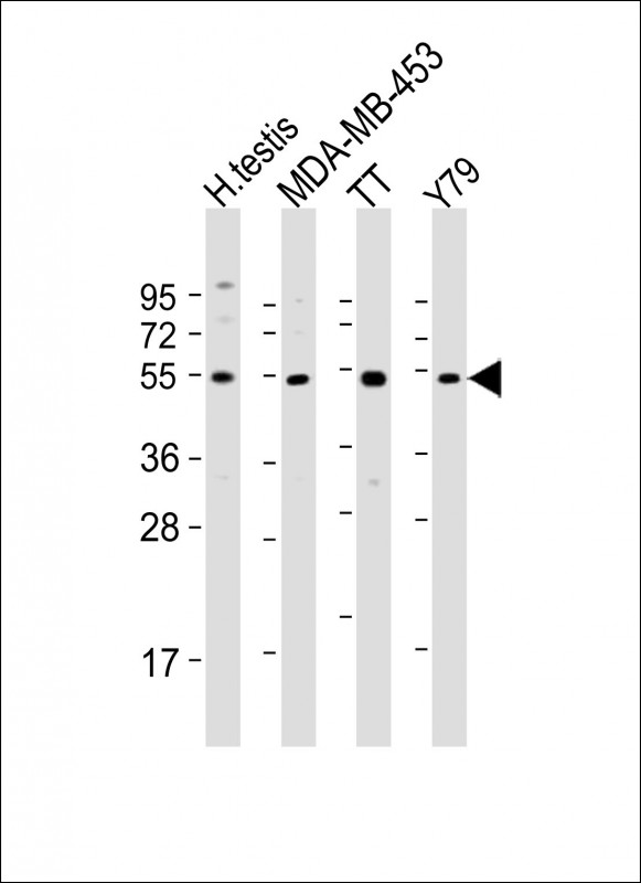 WDR51B