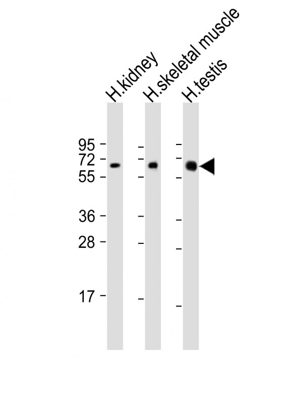 DMRT2