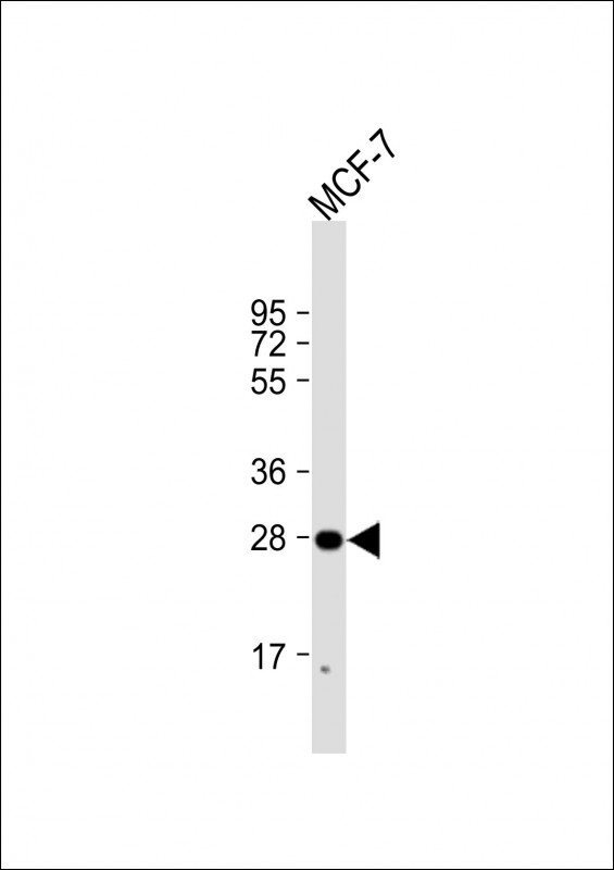 H1FNT (N-Term)