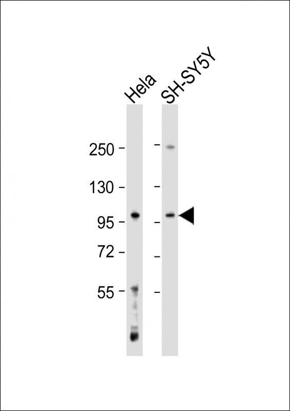GABBR1 (N-Term)