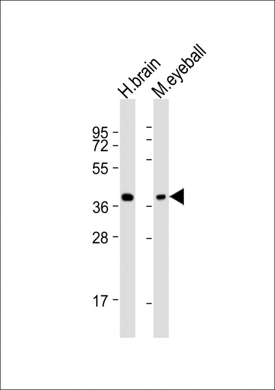 ARR3 (N-Term)