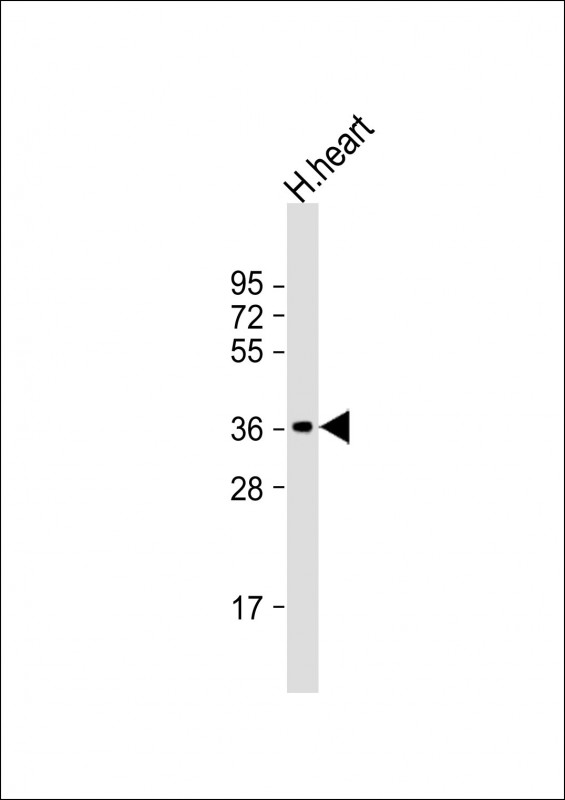 HUMAN-LDHB(Y240)
