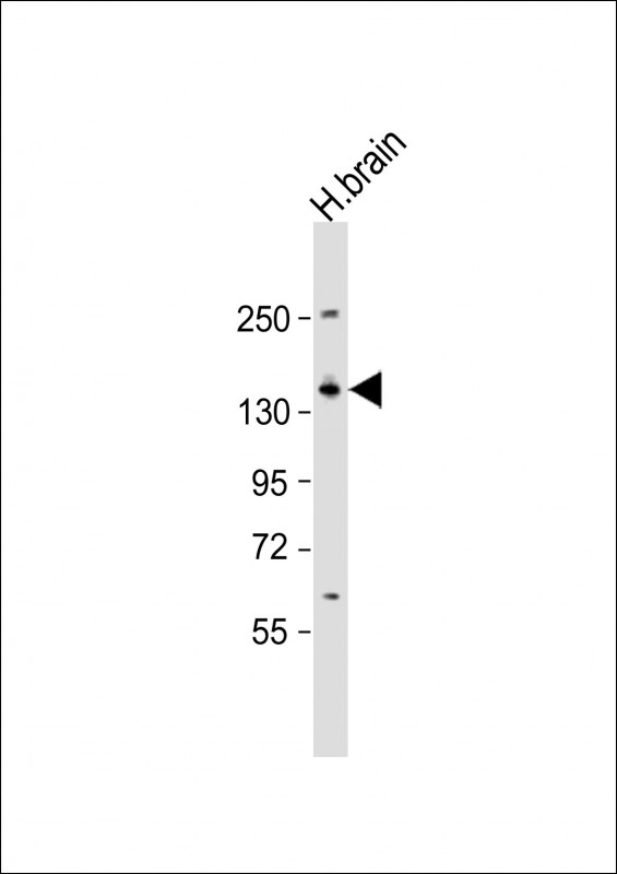 KCNMA1 (N-Term)