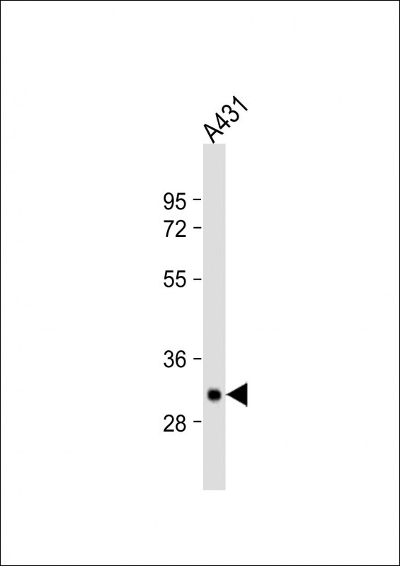 TPSAB1