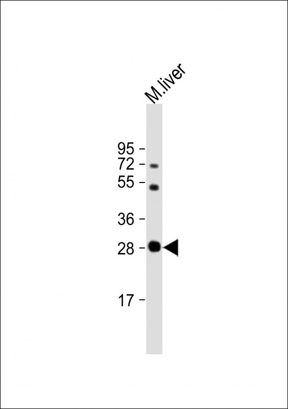 M Sirt3