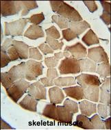 Rabbit Polyclonal Antibody to CFB