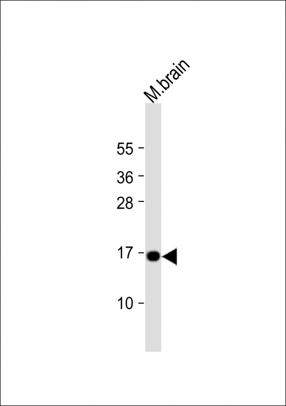 CPLX1