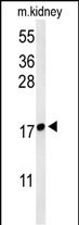 Rabbit Polyclonal Antibody to LYPD1
