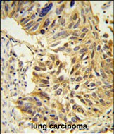 Rabbit Polyclonal Antibody to SDR