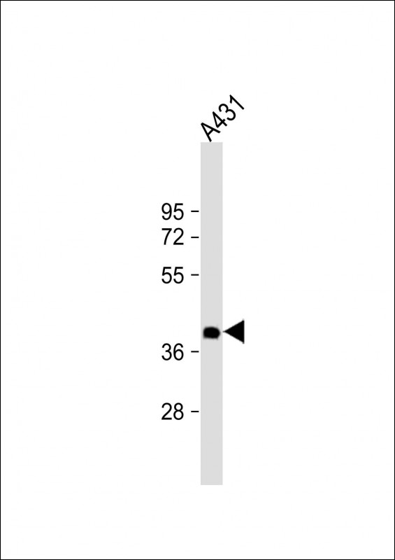 NMI