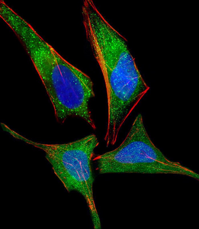Mouse Monoclonal Antibody to NMI