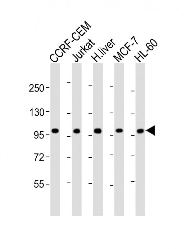 RSBN1 (N-term)