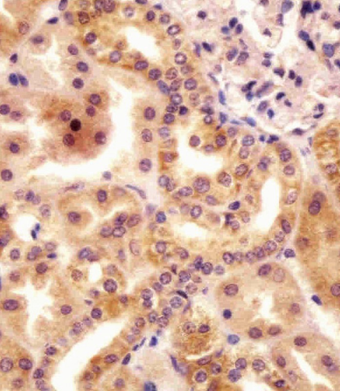 Rabbit Polyclonal Antibody to RSBN1 (N-term)