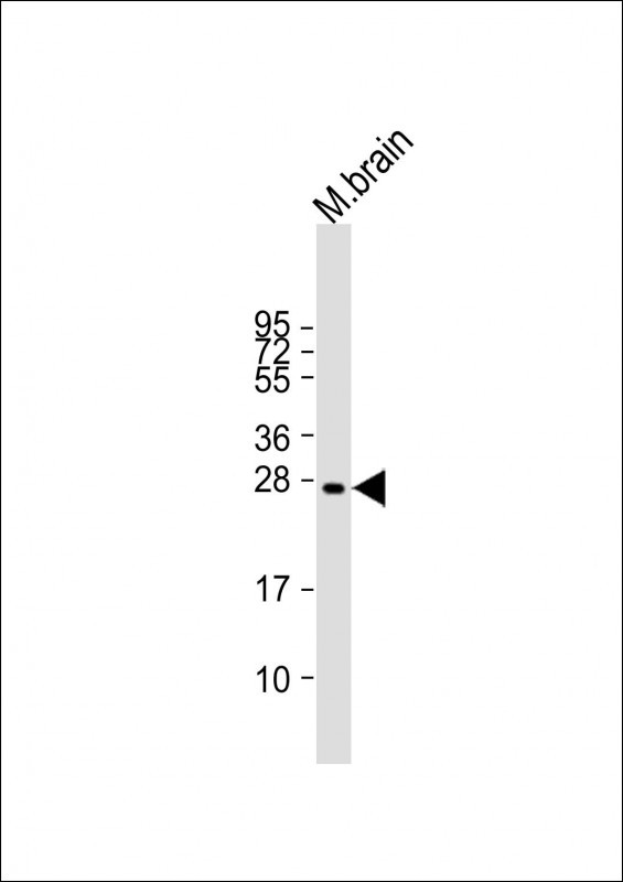 VKORC1L1 (N-term)
