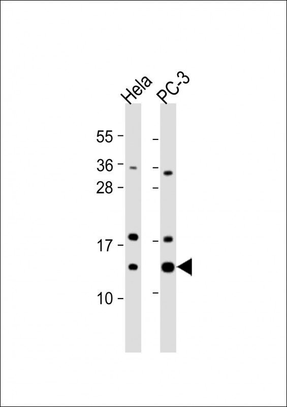 TCEB1