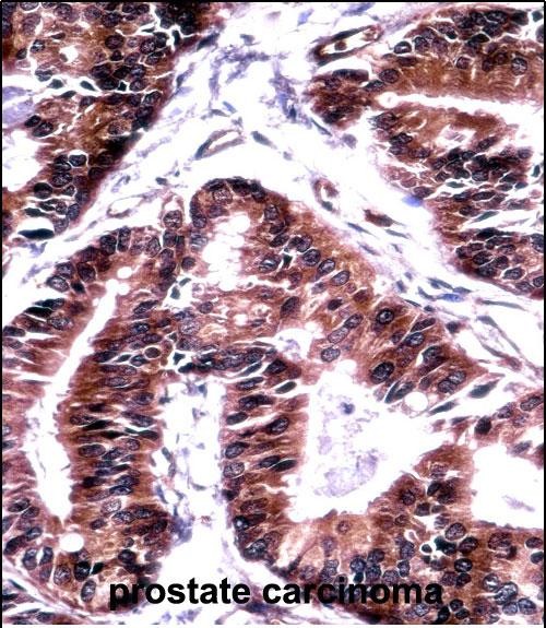 Rabbit Polyclonal Antibody to TCEB1