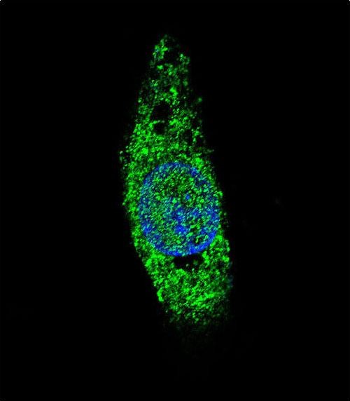 Rabbit Polyclonal Antibody to LIN28B