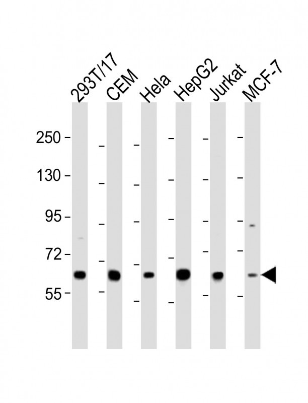 RNF31