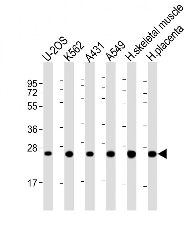 UQCRFS1P1