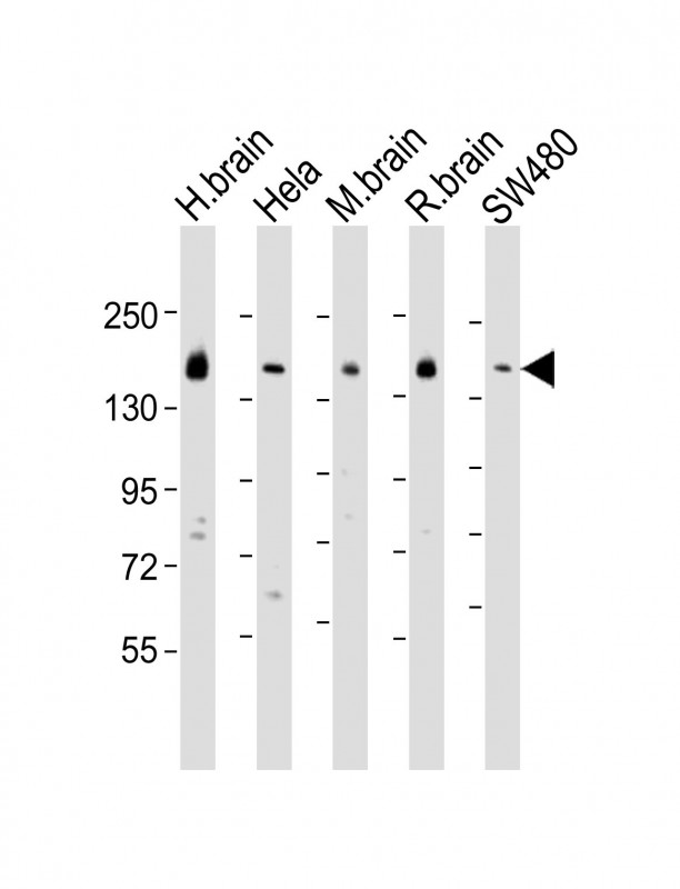 SYNJ1