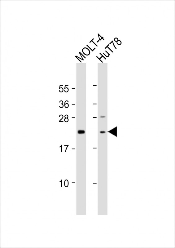DLEU7 (N-Term)