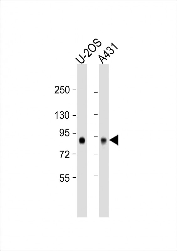 GPSM2 (N-Term)