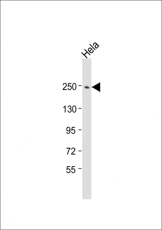 APC2 (N-Term)
